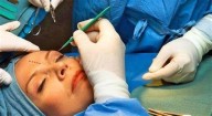 Continúa abierto Curso de Cirugía Estética de la UACh