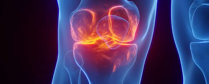 Do Your Knees 'Click'? Here's What It Means, And When to See a Doctor