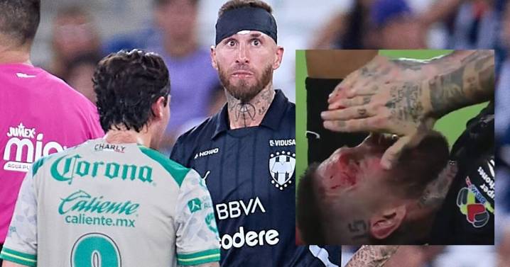 Sergio Ramos SANGRA del rostro por aparatozo golpe, en una noche agridulce para el jugador de Rayados de Monterrey