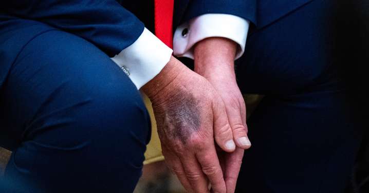 Trump, who questioned his opponents' health, rebuffs conspiracy theories about his own