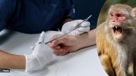What to do after a monkey bite: First aid, rabies risk, and expert advice