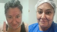 “Voy a quedar de 15”: Denisse Campos reveló detalles de sus nuevas cirugías estéticas