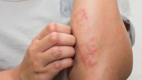 Una enfermedad que corrompe el cuerpo