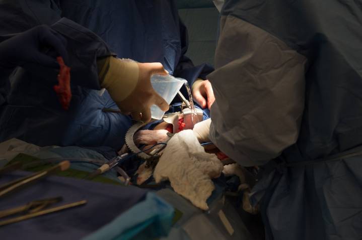 Florida hospitals challenge organ-transplant proposal – Sun Sentinel