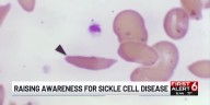 Omahans give blood, raise awareness of sickle cell disease