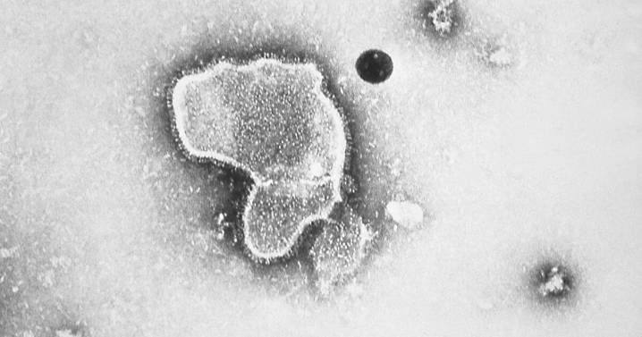 New study finds RSV vaccine may provide two years of protection to older adults