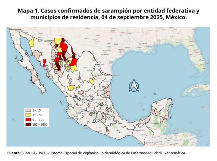 México perdería certificación libre de sarampión