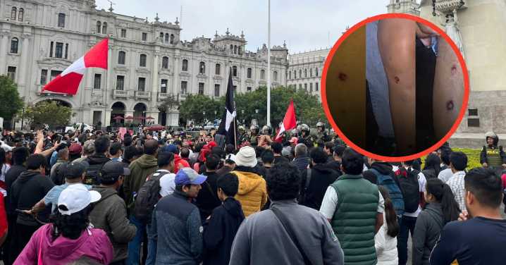 Marcha de 'Generación Z': PNP responsabiliza a periodistas heridos por no ubicarse en "espacios propicios"