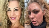 Exchica Mekano reaparece tras brutal agresión de su pareja: “Hoy celebro el milagro de estar viva”