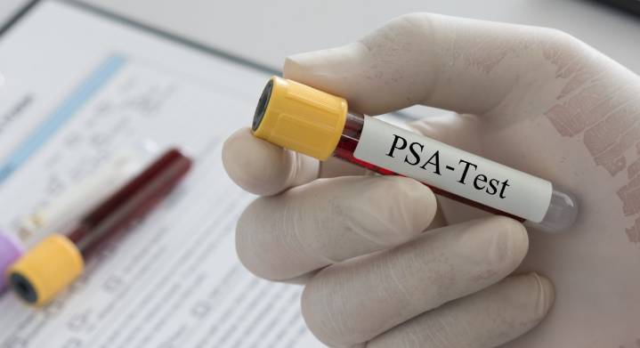 Mientras disminuyen pruebas de antígeno: tasas de cáncer de próstata aumentan anualmente en EE.UU.