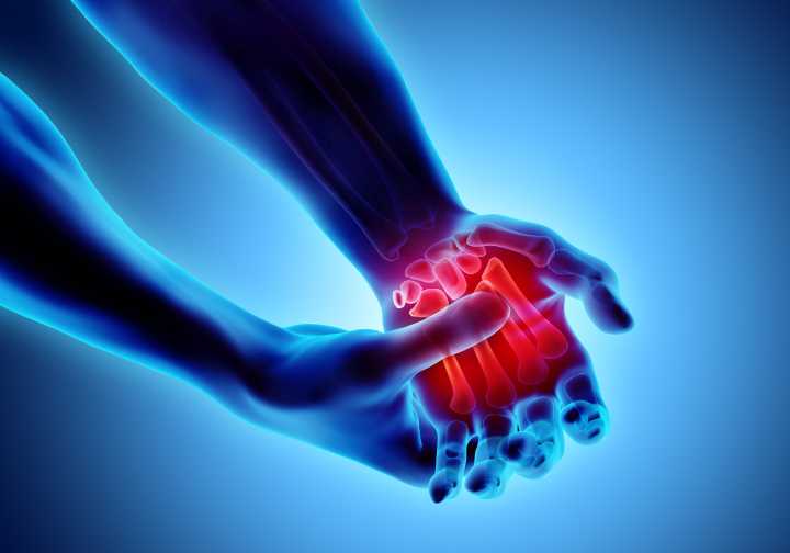 GLP-1s Improve Rheumatoid Arthritis Symptoms, Study Suggests