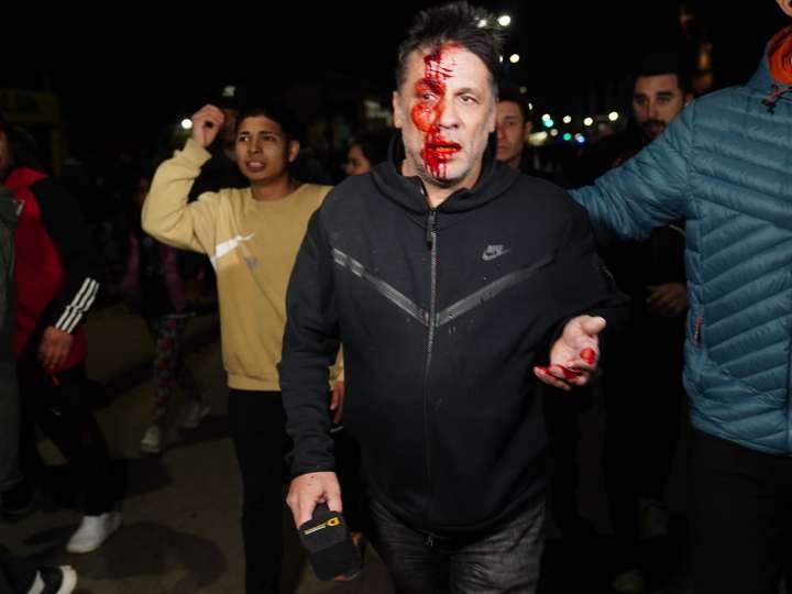 Habló Cristian Mercatante, el cronista herido en el cierre de campaña de Milei: "Este impacto a un nene lo mata"