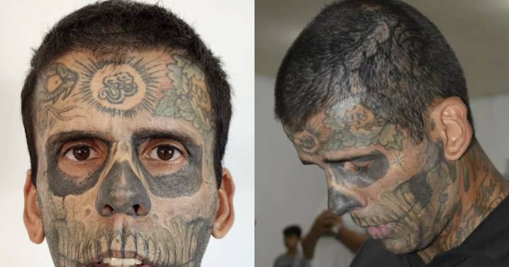 El hombre más tatuado de Brasil se borra más de 170 tatuajes y luce irreconocible