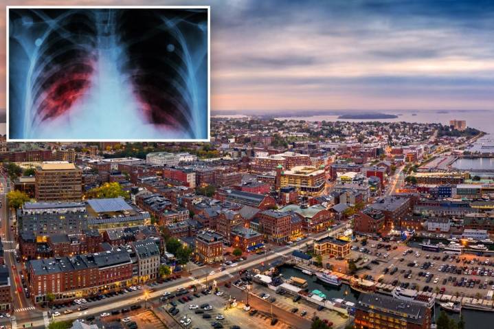 Three people in Maine have active tuberculosis, the world’s deadliest disease