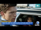 Tom Holland injured on new 'Spider