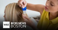 Number of Google searches about lice on the rise as kids return to school