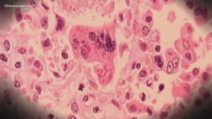 Virginia confirms fourth measles case in 2025 with child in Hampton Roads