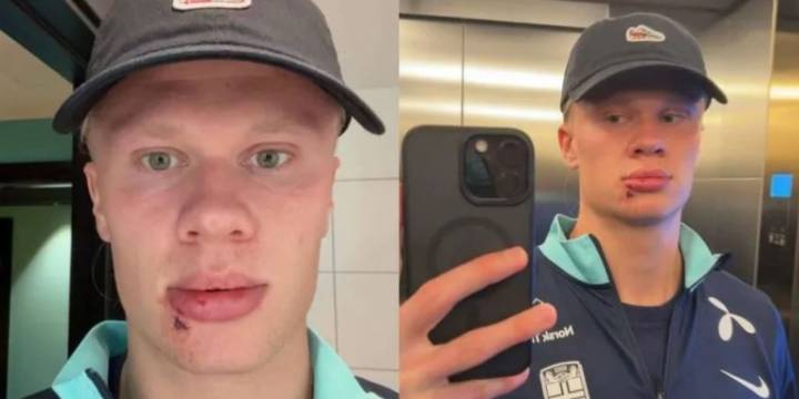 El llamativo accidente que sufrió Erling Haaland con el micro de la selección de Noruega