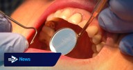 Labour claim Scotland’s dental services ‘wobbling’ under the SNP