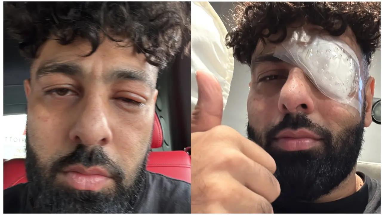 Badshah undergoes emergency eye surgery post on-stage mishap during US tour
