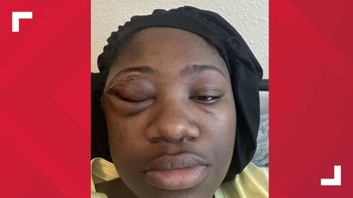 Woman sues APD, city of Austin over injuries at 6th Street shooting