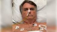 Jair Bolsonaro es diagnosticado con cáncer de piel; le extirpan lesiones cutáneas