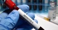 La infección activa de la hepatitis C en personas con VIH cae por debajo del 1%