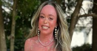 Teen With Ichthyosis With Confetti Goes Viral on TikTok: 'Shed the Stigma'