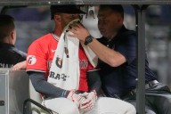 Guardians’ David Fry taken to Cleveland Clinic for further tests after taking pitch to the face