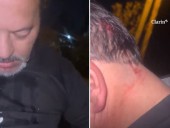 El fundador de una ONG de víctimas mató a uno de los seis delincuentes que quisieron robarle el auto en La Matanza