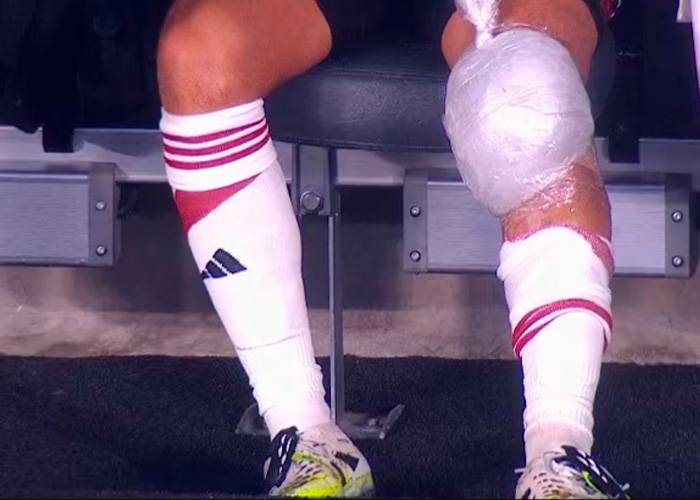 Alarmas en Colombia por Juan Fernando Quintero, problemas con su rodilla izquierda