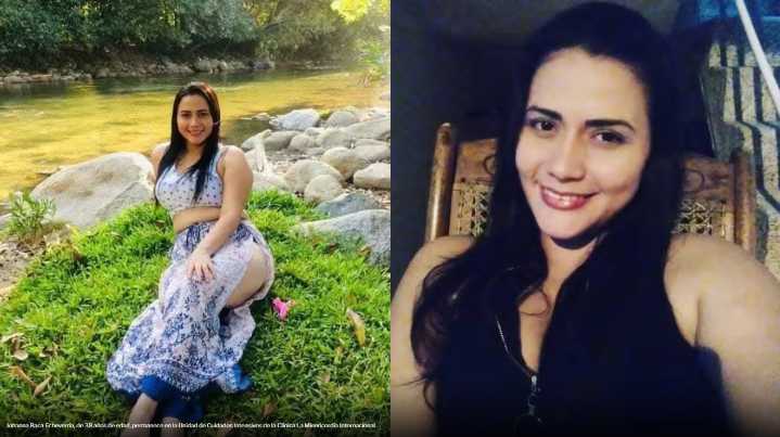 Johanna Baca continúa en la UCI tras sufrir fuerte caída en Soledad: ya ha pasado por cuatro cirugías