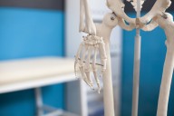 Adiós a la escayola: inventan un pegamento que es capaz de reparar huesos rotos en solo unos minutos