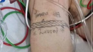 Difunden tatuaje de joven herida en explosión de pipa en Iztapalapa para identificarla
