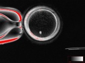 Scientists create human eggs in the lab, using skin cells