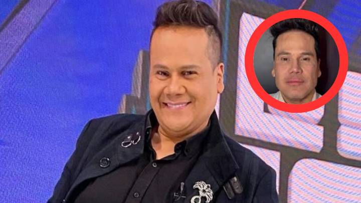 Ariel Osorio se sometió a procedimiento estético y el resultado generó polémica: “Definamos sutil”