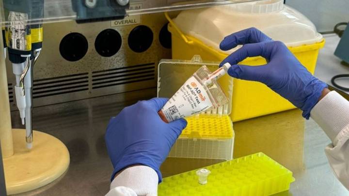 Un test de sangre predice qué personas con deterioro cognitivo leve tendrán alzhéimer