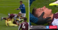 Jugador de Aston Villa acabó con enorme chichón en la frente: chocó con su compañero Dibu Martínez