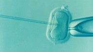Logran por primera vez generar óvulos humanos potencialmente fecundables a partir de células de la piel