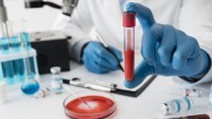 Un algoritmo de Harvard es capaz de descubrir el cáncer de VPH antes que los síntomas #14Sep