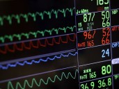 Ask the Expert: Early treatment key to protect heart function