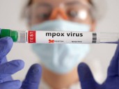 Mpox deja de ser emergencia sanitaria internacional, confirma la OMS