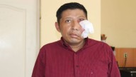 Día Internacional de la Investigación contra el Cáncer: el testimonio de Albert y el aumento de melanomas en México