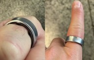 La batería de un anillo inteligente se infló por lo que no podía quitáselo