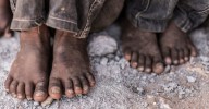 La desigualdad social provoca cambios en el cerebro de los niños y empeora su salud mental