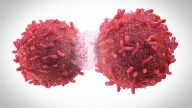 Un estudio de "Lancet" alerta: en 2050 las muertes por cáncer aumentarán casi un 75% respecto a 2024