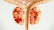 Galicia comienza a producir un nuevo radiofármaco para el diagnóstico avanzado del cáncer de próstata