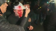 Quién es el herido en la previa del acto de Javier Milei en Moreno