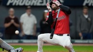 David Fry recovering after sustaining broken nose, facial fractures after being hit in face by pitch