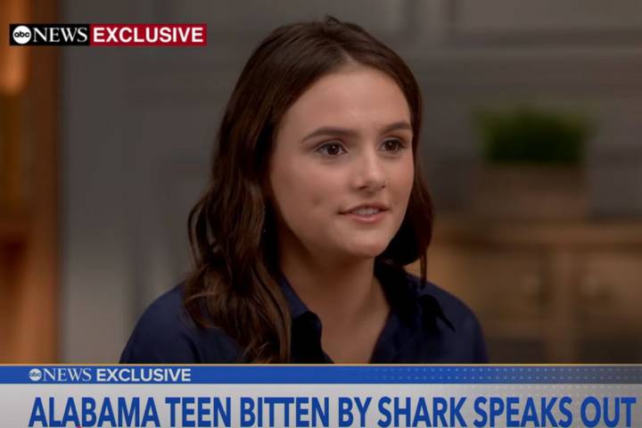 Teen Who Lost Hand, Leg in Shark Attack Grateful to Be Alive